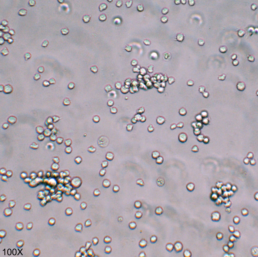 Kasumi-1 人急性髓母白血病细胞