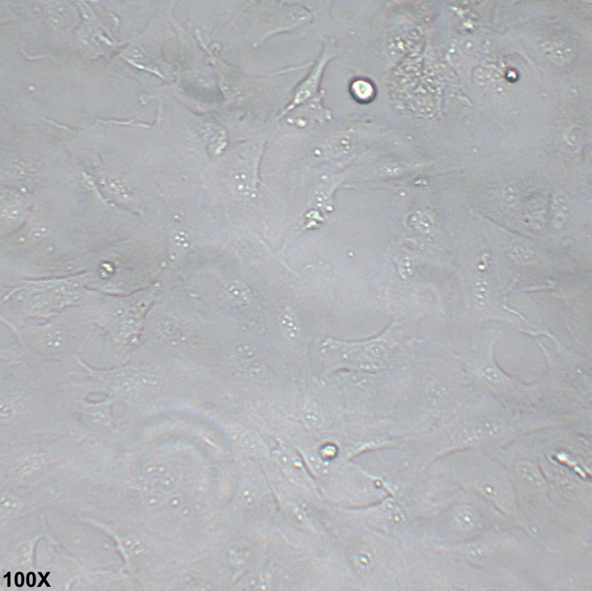 SNU-423 人肝癌细胞