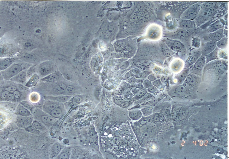SCC-4 人舌鳞癌细胞