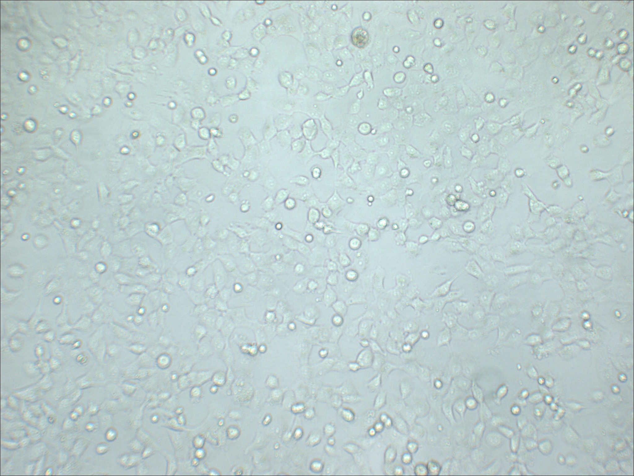 NCI-H1299 人非小细胞肺癌细胞