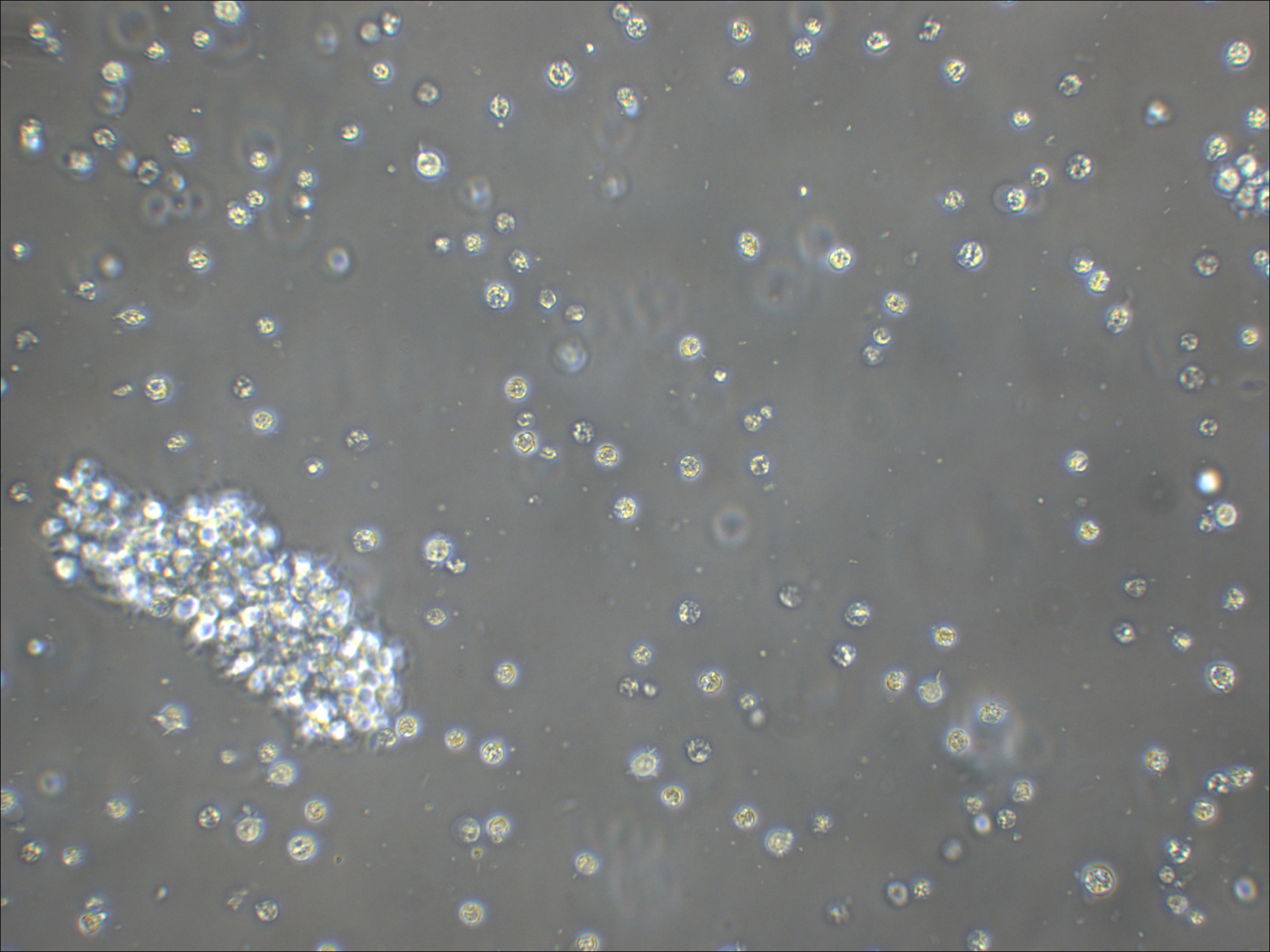 SU-DHL-10 人B细胞淋巴瘤细胞