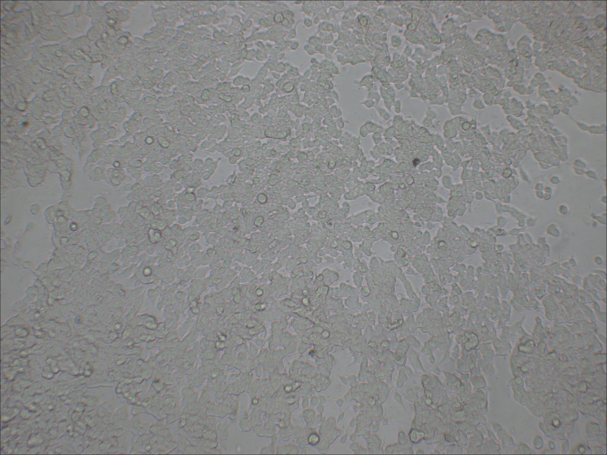 NCI-H3122 人肺腺癌细胞