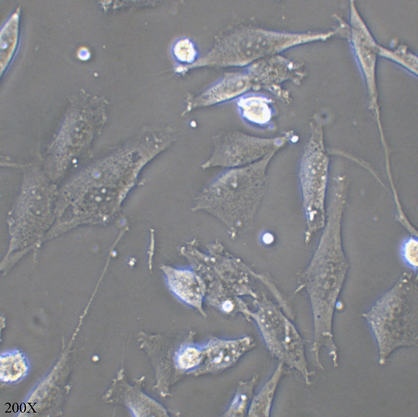 U-118 MG 人脑星形胶质母细胞瘤细胞