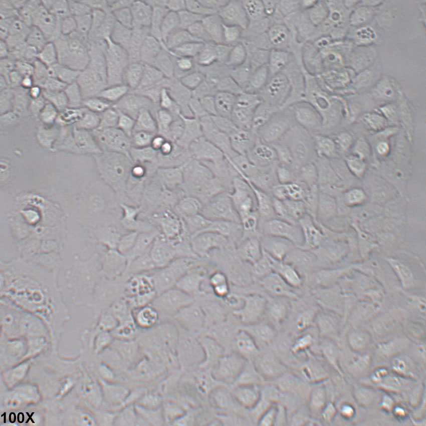 SW780 人膀胱移行细胞癌细胞