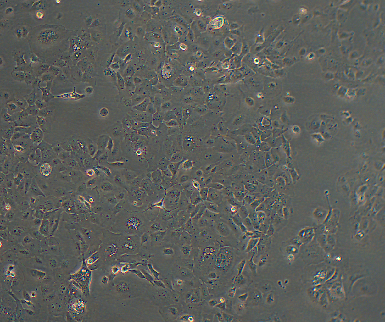 SW1990 人胰腺癌细胞（二级腺癌）