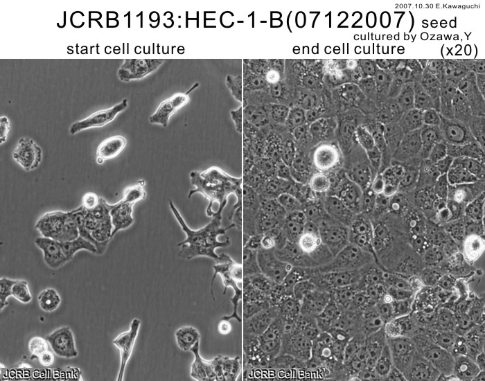 HEC-1-B 人子宫内膜腺癌细胞