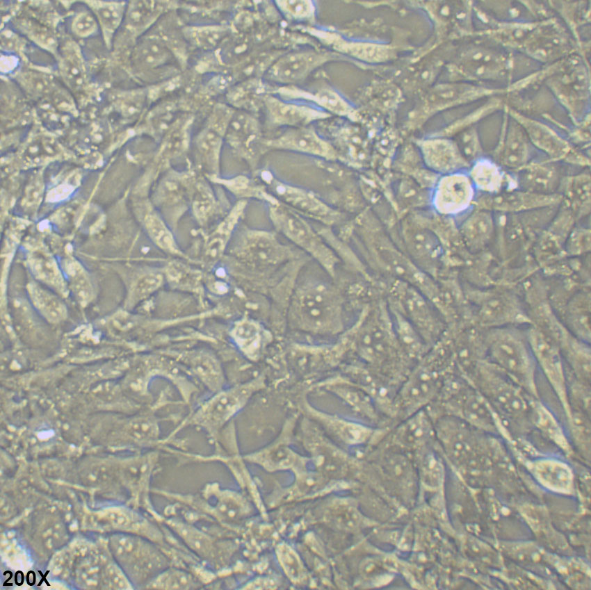 ES-2 人卵巢透明细胞癌细胞