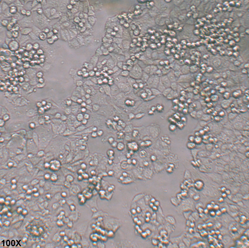 C-33A 人宫颈癌细胞