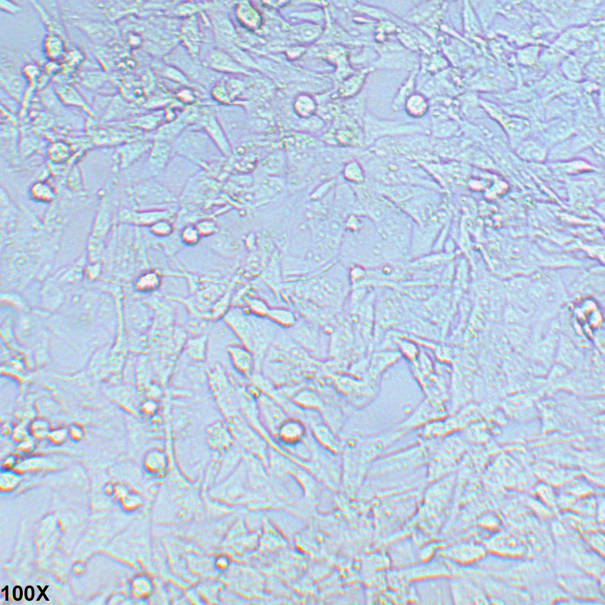 UM-UC-3 人膀胱移行细胞癌细胞