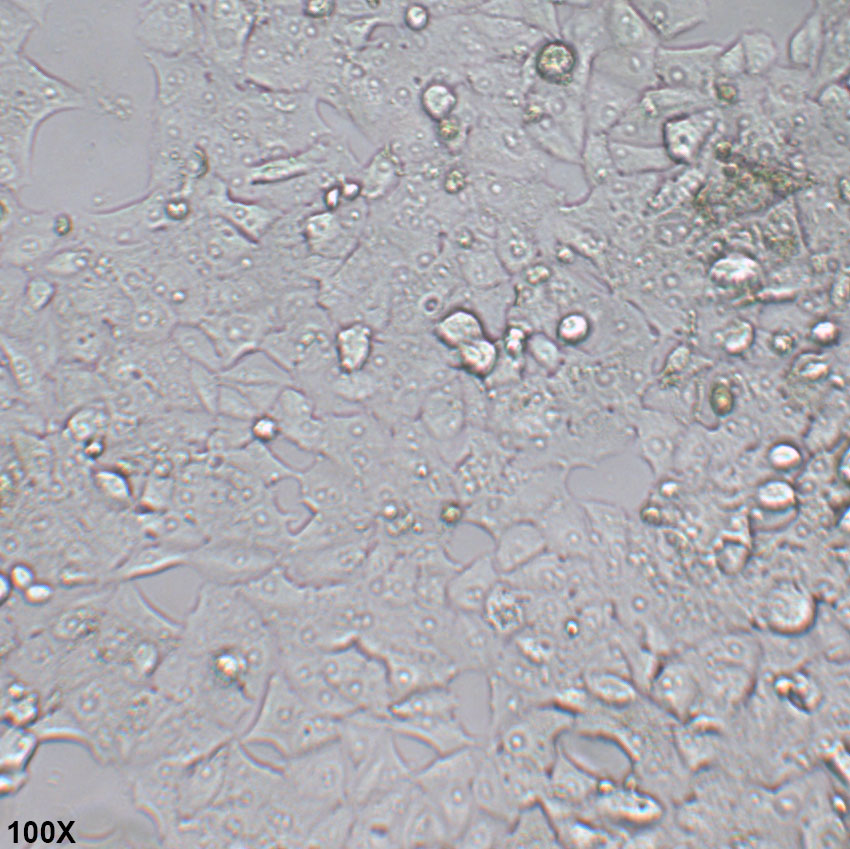 NCI-H1395 人肺腺癌细胞