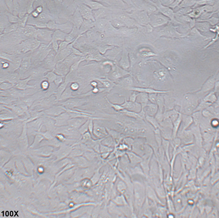 Calu-1 人肺癌细胞