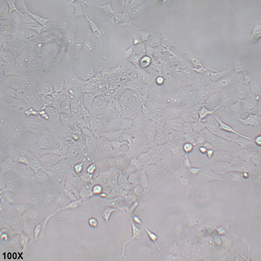 Kyse-140 人食管鳞癌细胞