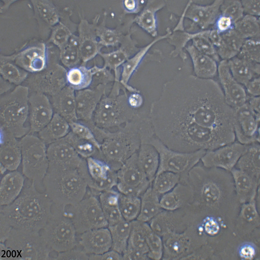 FaDu 人咽鳞癌细胞