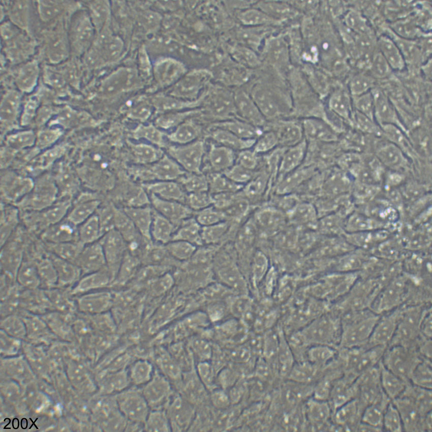 HCT-8 人结直肠腺癌细胞