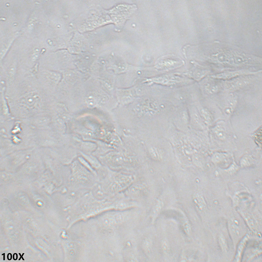 COV504 人卵巢上皮浆液性癌细胞