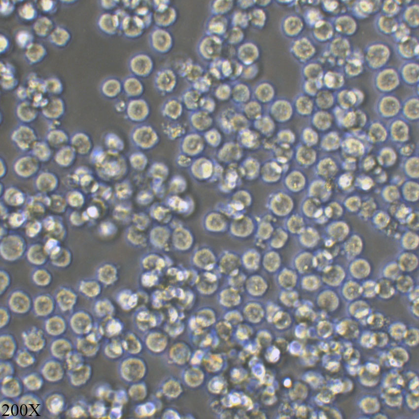 K562 人慢性髓原白血病细胞