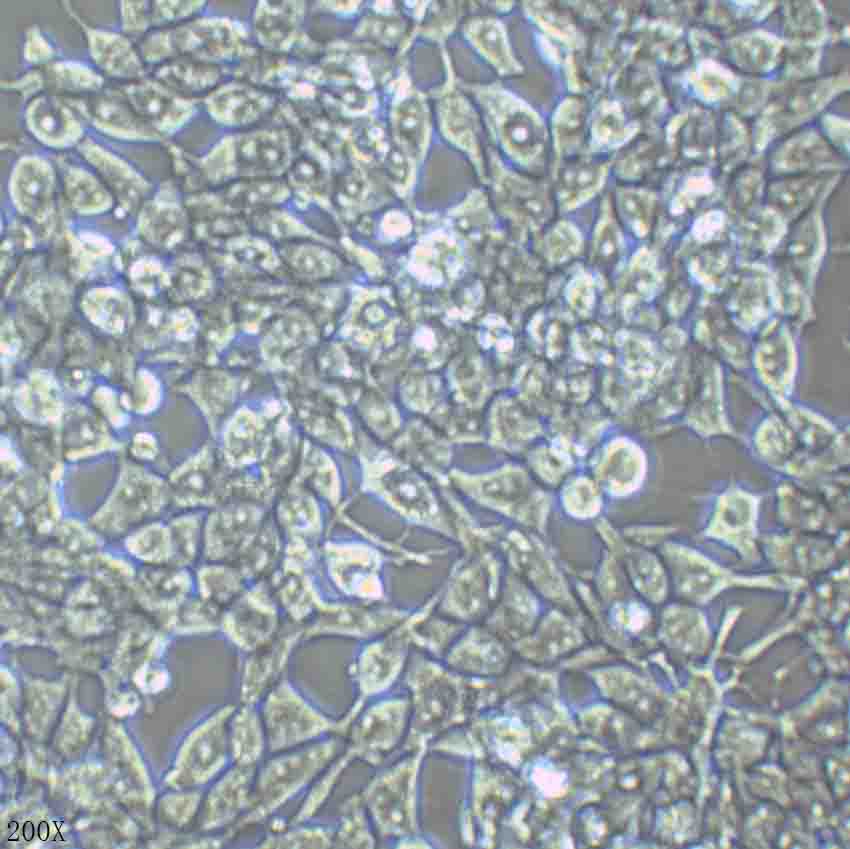 LNCaP 人前列腺癌细胞