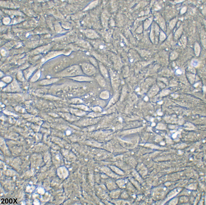 SV40 MES 13 小鼠肾小球系膜细胞
