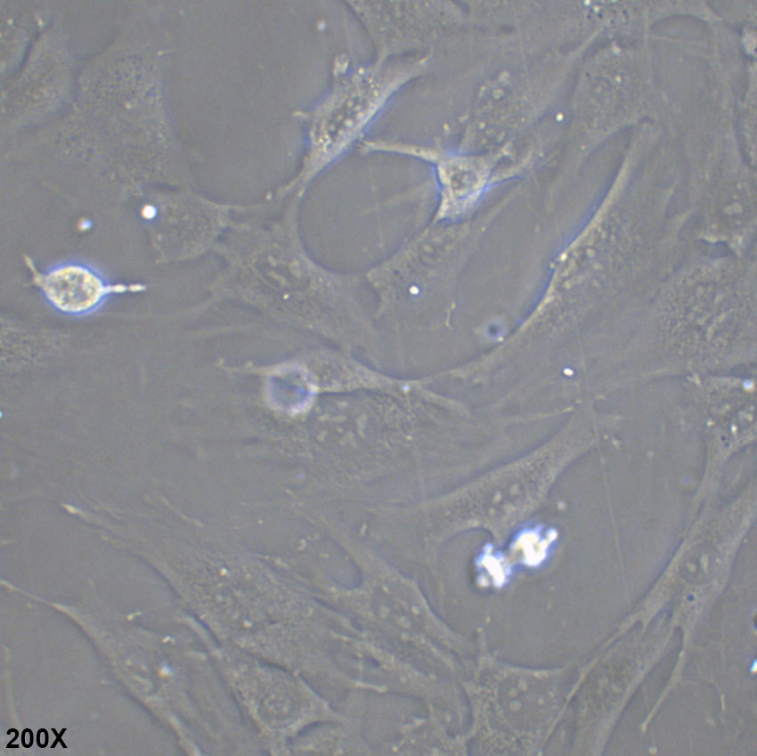 3T3-L1 小鼠胚胎成纤维细胞