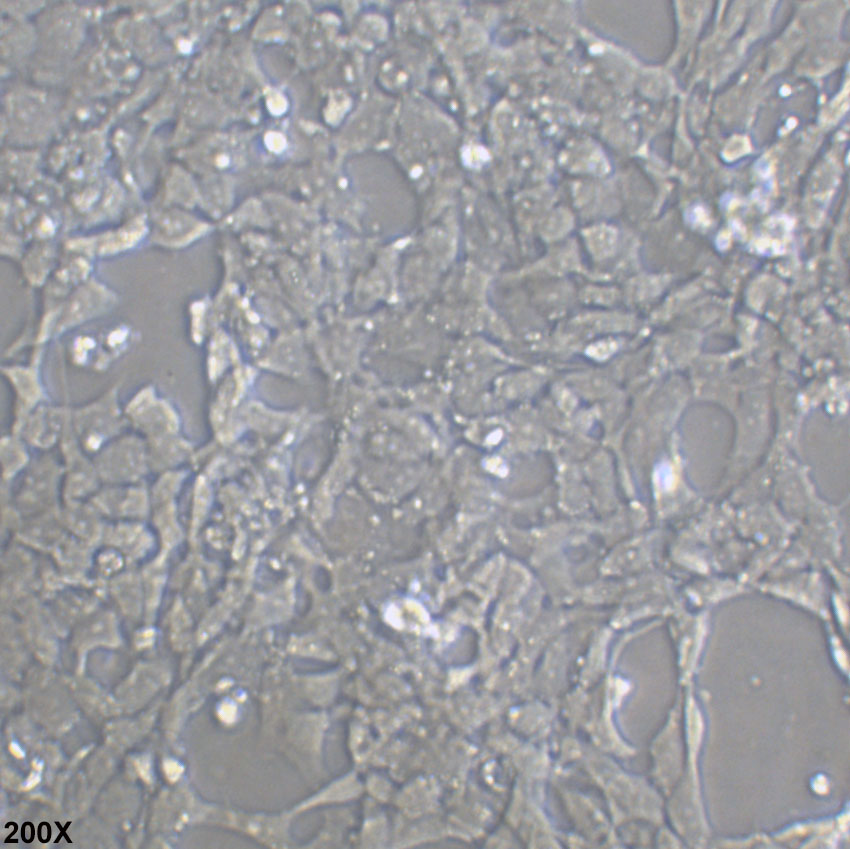 SK-N-MC 人神经上皮瘤细胞