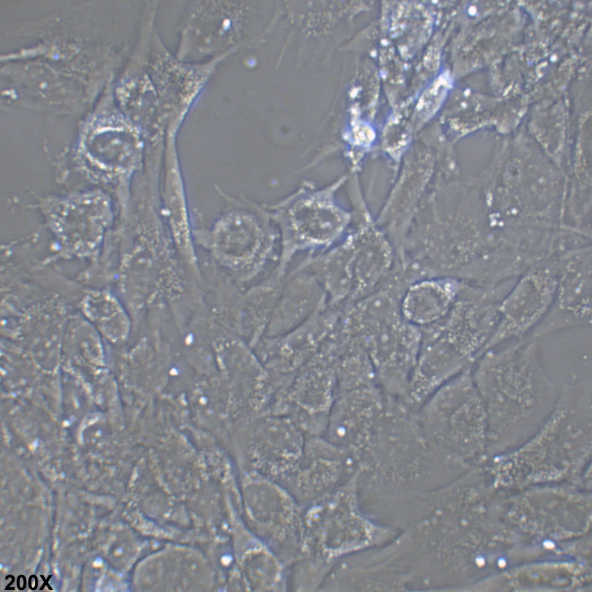 SW1088 人脑星形胶质细胞瘤细胞