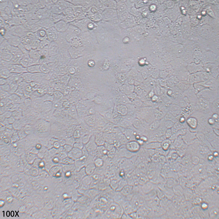 Ca ski 人宫颈癌上皮细胞