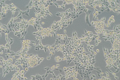 LLC 小鼠lewis肺癌细胞