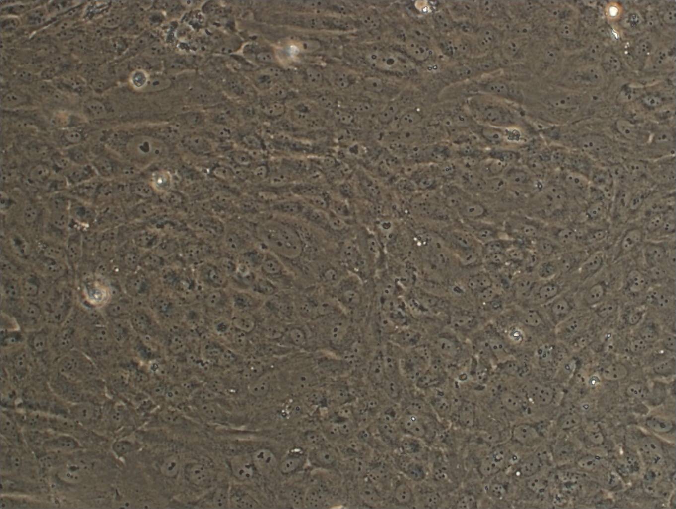 SW1353 人骨肉瘤细胞