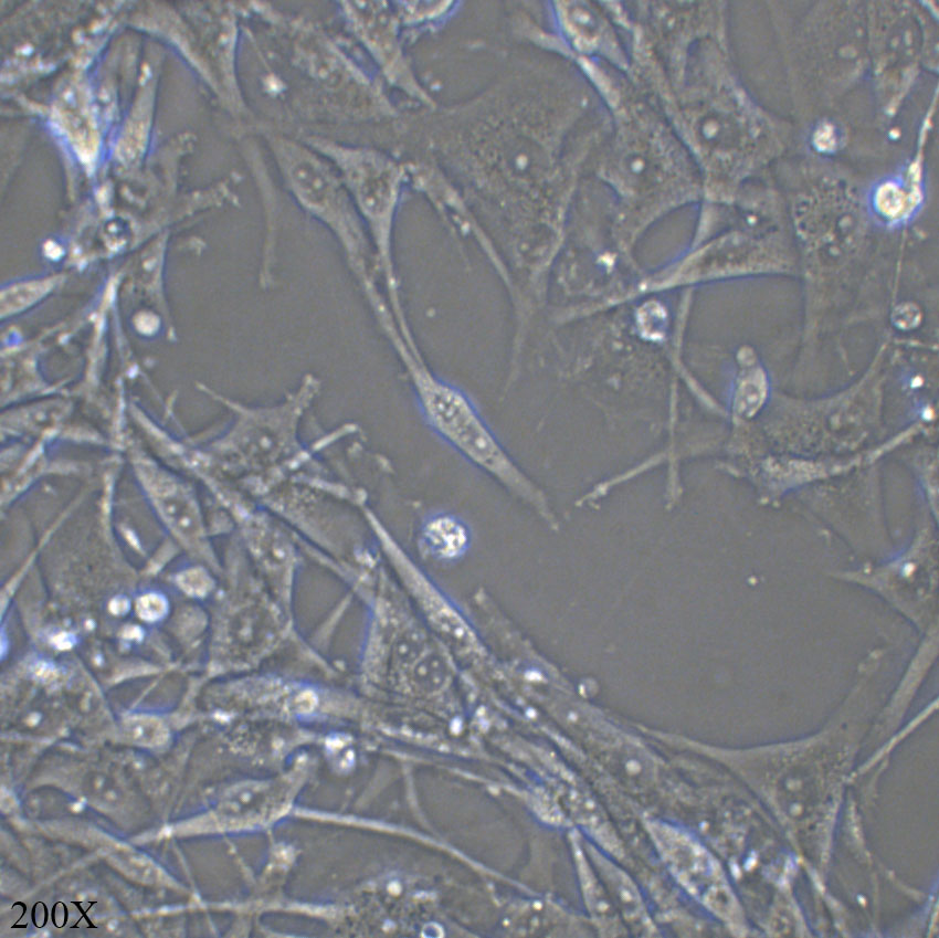 U-87 MG 人脑星形胶质母细胞瘤细胞