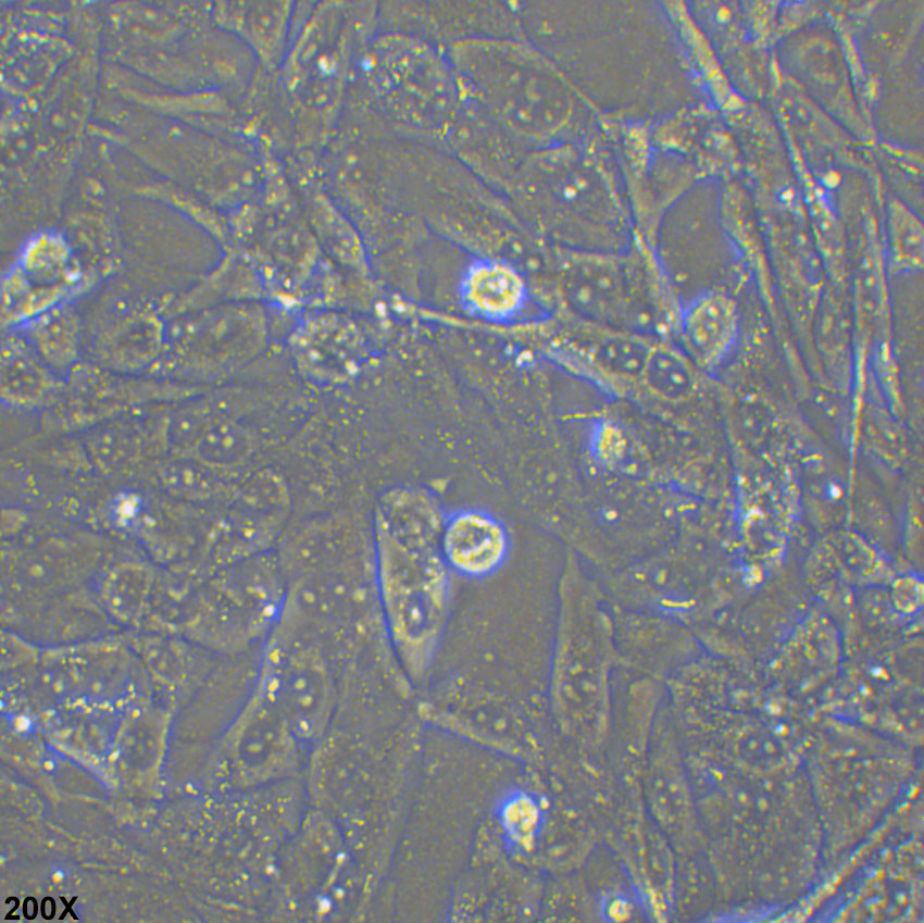 UM-UC-3 人膀胱移行细胞癌细胞