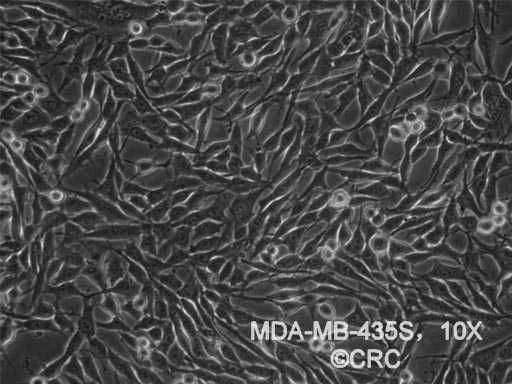 MDA-MB-435s 人乳腺癌细胞