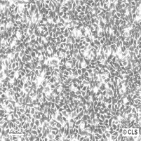 BT-20 人乳腺癌细胞