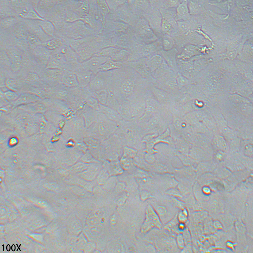 Kyse-520 人食管鳞癌细胞