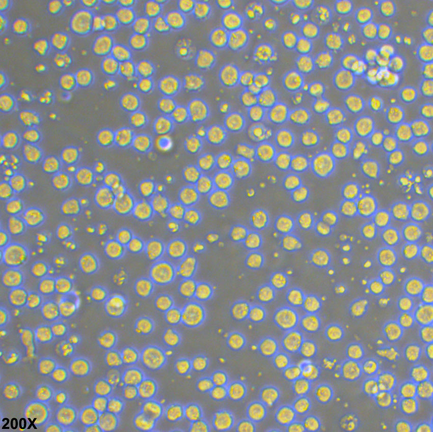 CCRF-CEM 人急性淋巴细胞白血病T淋巴细胞