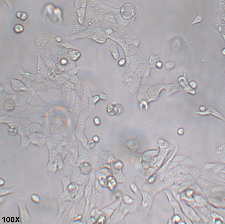 CFPAC-1 人胰腺癌细胞