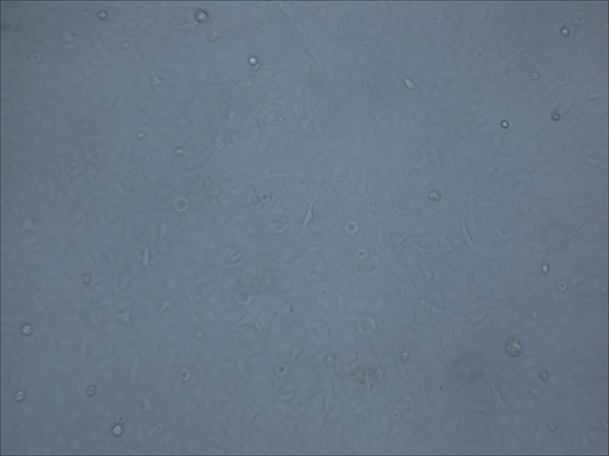 K1 人甲状腺癌细胞（乳头状）