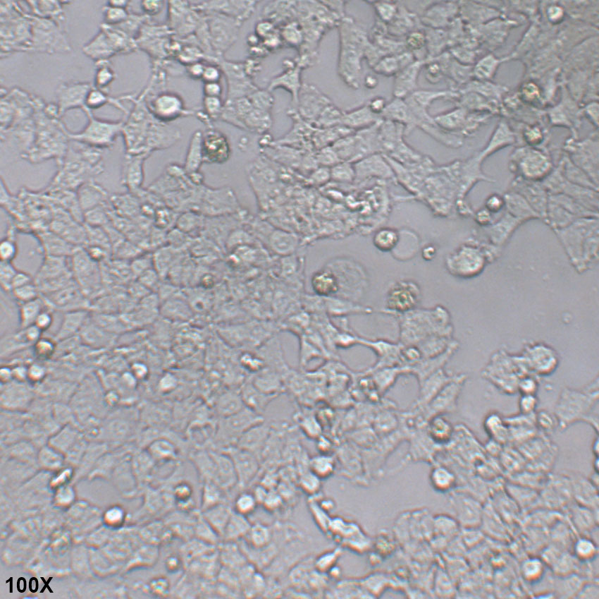 MHCC97-H 人高转移潜能肝癌细胞