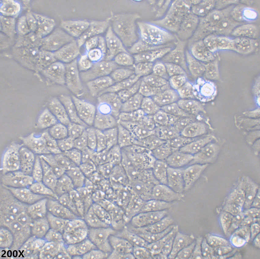 T47D 人乳腺导管癌细胞