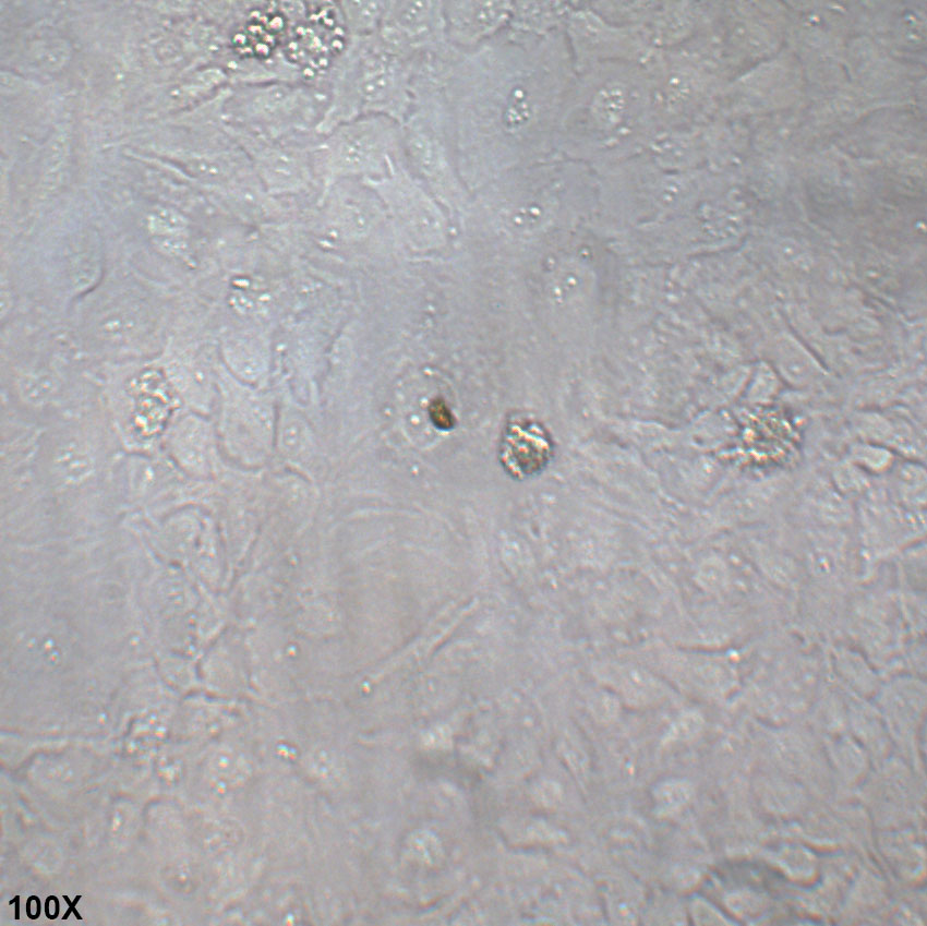 TCCSUP 人膀胱癌细胞