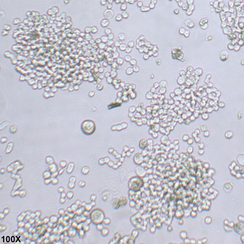 COLO 320DM 人结直肠腺癌细胞
