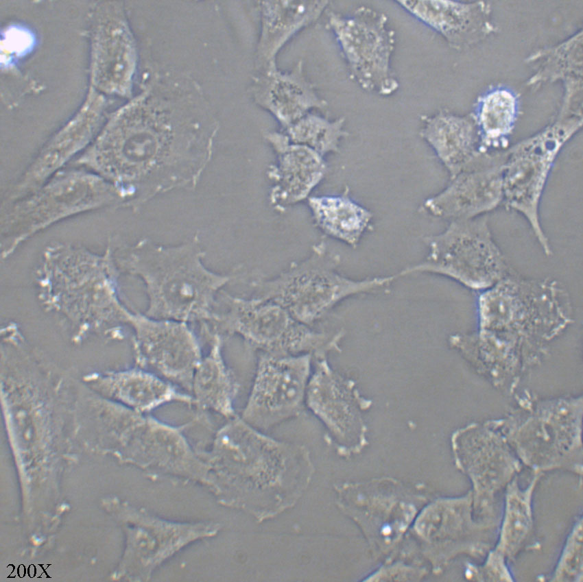 SW579 人甲状腺鳞癌细胞
