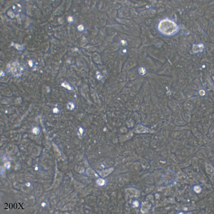 HCT-15 人结直肠腺癌上皮细胞