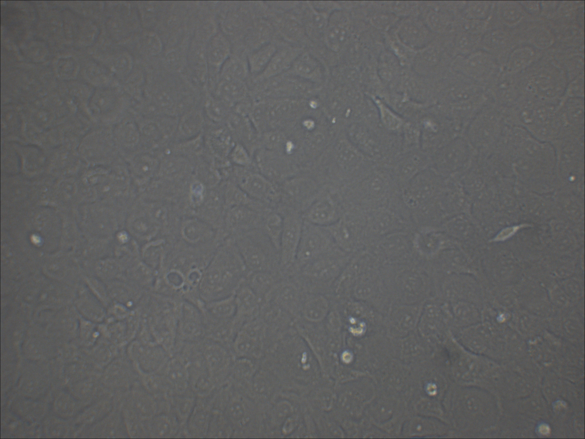 K1 人甲状腺癌细胞（乳头状）