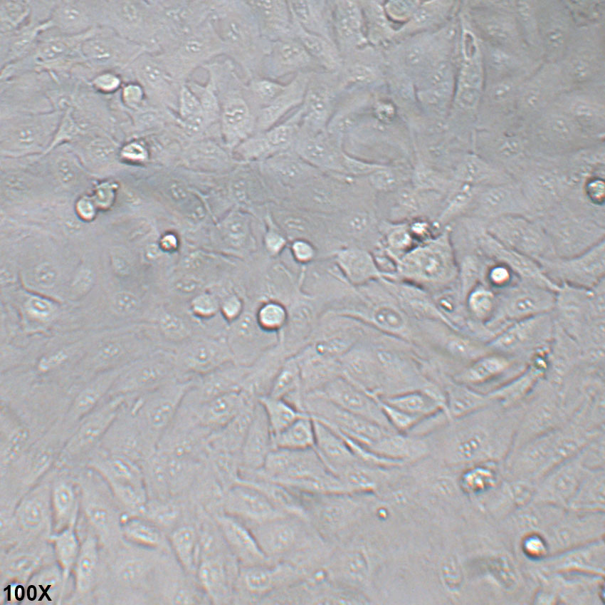 A-875 人黑色素瘤细胞