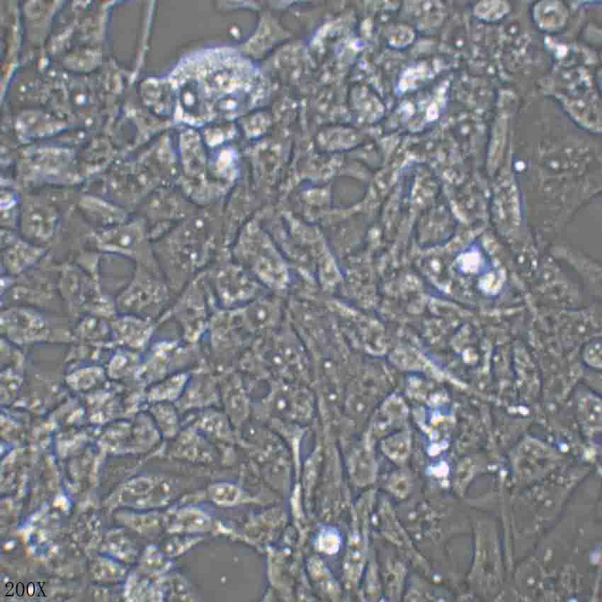 RD 人恶性胚胎横纹肌肉瘤细胞