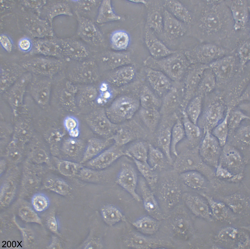 5637 人膀胱癌细胞