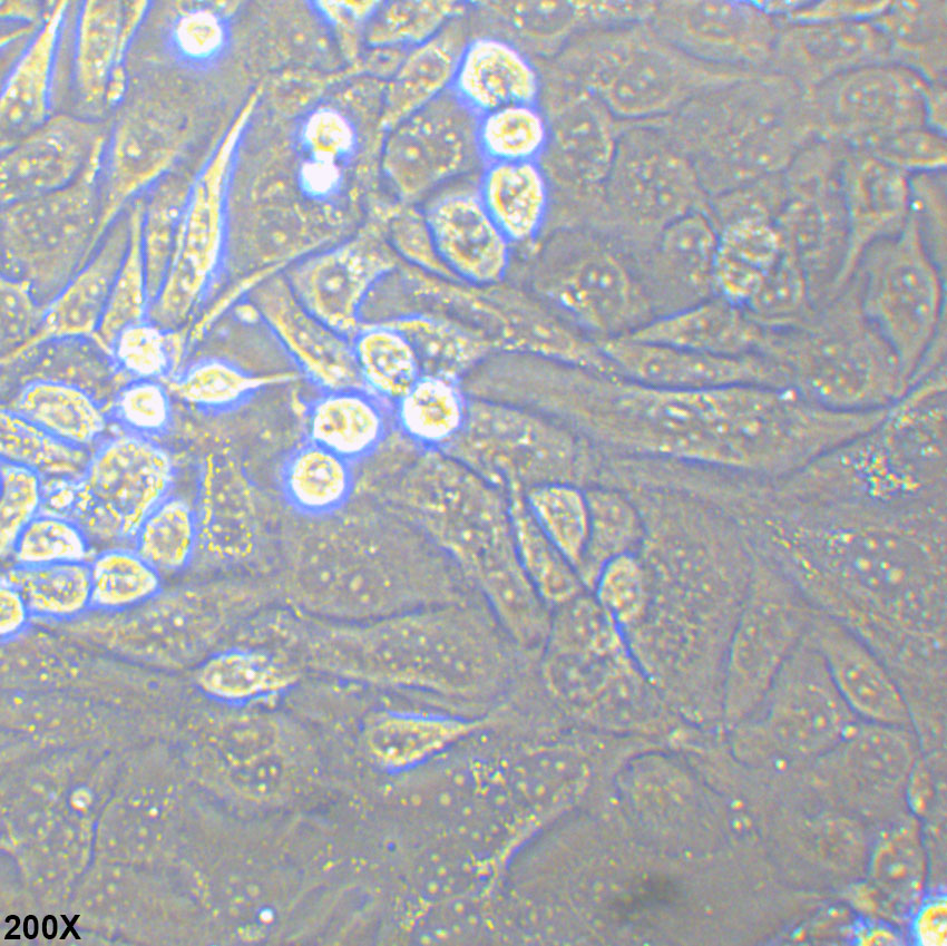 Anglne 人卵巢癌细胞