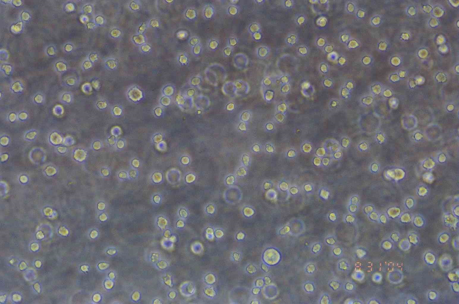 CA46 人Burkitt's淋巴瘤细胞