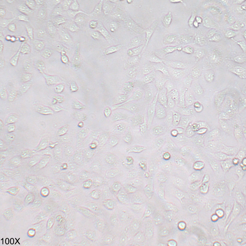 5637 人膀胱癌细胞
