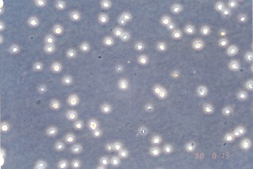 U266B1 人骨髓瘤细胞